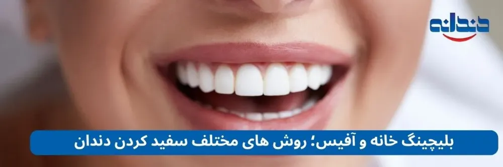 بلیچینگ خانه و آفیس؛ روش های مختلف سفید کردن دندان